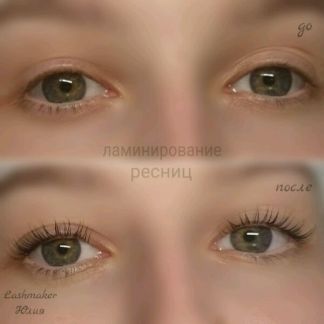 Кожа пятнами и красная после загара Кожа пятнами и красная после загара