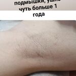 Ирина:  Электроэпиляция/шугаринг/воск