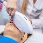 Beauty Technology :  Лазерная эпиляция верхней губы со скидкой 65%!