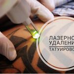 Анастасия:  Удаление татуажа, татуировок, перманентного макияжа