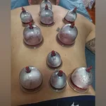Равиль:  Хиджама