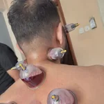 Равиль:  Хиджама