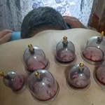 Равиль:  Хиджама