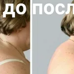 Равиль:  Хиджама