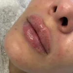 Екатерина:  Врач-косметолог 