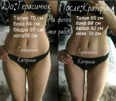 Вакуумный массаж от целлюлита краснодар