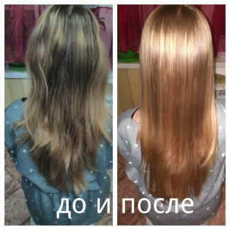 Лечение волос в анапе