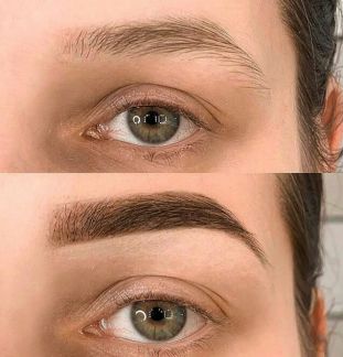 Микроблейдинг