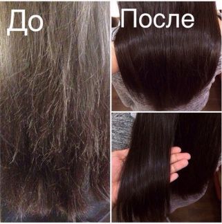 Лечение волос в анапе