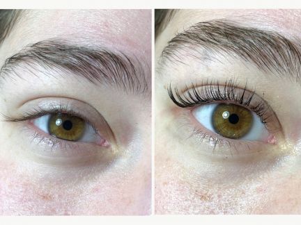 Аллергия на ламинирование ресниц. Аллергия от ламинирования ресниц. Аллергия после ламинирования бровей