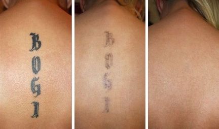 Сколько стоит коррекция бровей после татуажа в туле