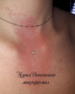 Где в новороссийске можно ребенку проколоть уши