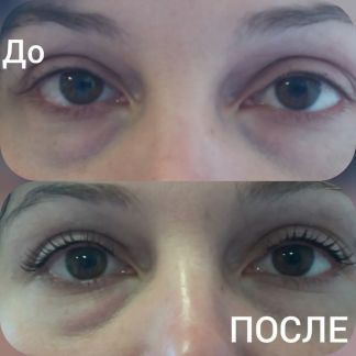 Томске можно нарастить волосы