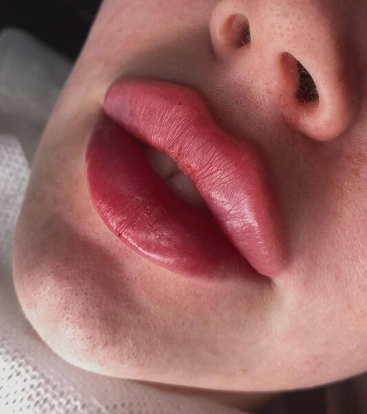 Услуги косметолога