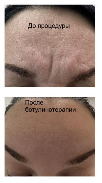 Юлия:  Аппаратная/инъекционная косметология 