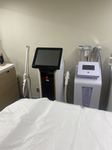 Лазерная эпиляция