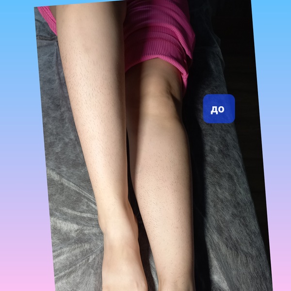 Депиляция воском .принимаю только женщин 