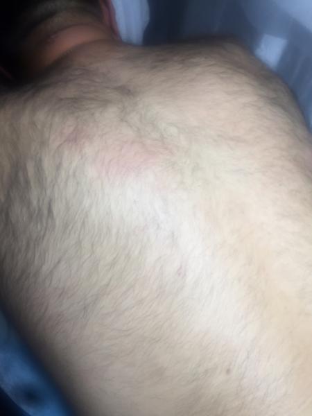 Мужская депиляция