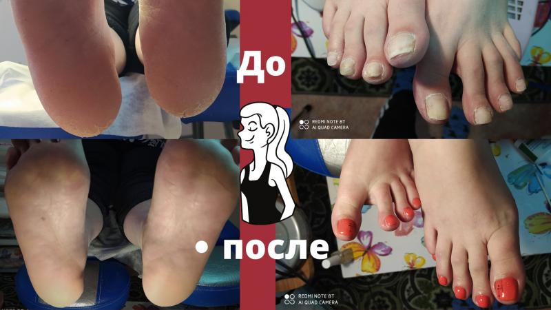 ПЕДИКЮР ЭСТЕТИЧЕСКИЙ,МАНИКЮР.УКРЕПЛЕНИЕ.