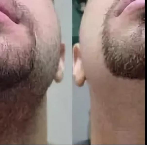 Как убрать бороду воском